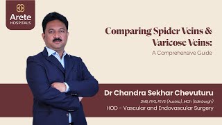 Are Spider Veins Dangerous How do they differ from varicose veins  Dr Chandra Sekhar Chevuturu [upl. by Hebrew]