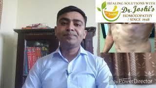 Lipoma Homeopathic Medicine For lipoma [upl. by Aufmann]