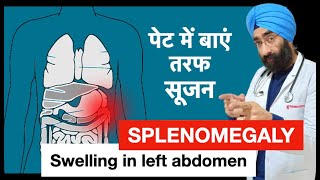 पेट में सूजन हो सकती है स्प्लीन  Splenomegaly  Swelling in Spleen  DrEducation [upl. by Mandle945]