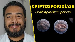 Criptosporidíase Cryptosporidium parvum  Curso de Parasitologia Humana Básica e Clínica [upl. by Sedecrem]