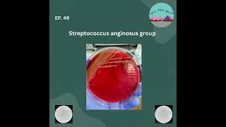 TBT Streptococcus anginosus group [upl. by Penn]