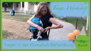 Buzzidil TrageWorkshop  Tragen während der KlumpfußBehandlung [upl. by Eidaj484]