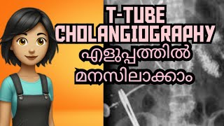 TTUBE CHOLANGIOGRAPHY Complete study explained in Malayalam [upl. by Serles824]