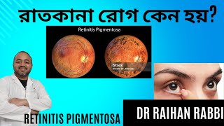 🔴 Retinitis Pigmentosa Symptoms signs and treatment  রাতকানা রোগ কেন হয় এ রোগের চিকিৎসা কী [upl. by Valleau]