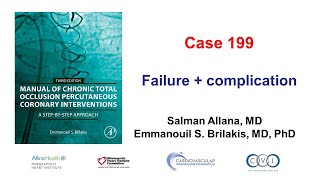 Case 199 Manual of CTO PCI failure and complication [upl. by Libnah474]