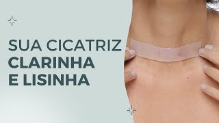 COMO FUNCIONA A FITA DE SILICONE PARA CICATRIZ SUPÉRBIA [upl. by Delphina71]