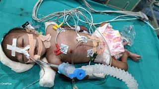 newborn emergencyelectrode placementEt suction 😞ytshorts viral newbornnicu emergencybabycare [upl. by Alig245]