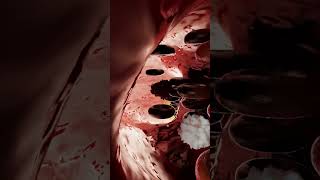 What Do Blood Clots Look Like and How Are They Formed [upl. by Consuelo]