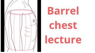 Barrel chest chestconditionrespiratorydisease [upl. by Mesics]