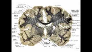 Neuropathology101Basic Neurohistology and NonNeoplastic lesionsmov [upl. by Niela]