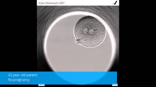 Time lapse monitoring of zona pellucida free embryos obtained through mild IVF [upl. by Rame]