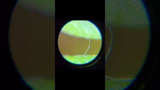 Hidden Wonders of a Terrarium under a Microscope shorts [upl. by Eelarol]