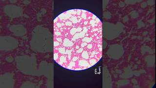 1Simple squamous epithelium explanation location function amp lung histology microscope anatomy [upl. by Amasa]