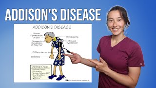 Addison’s Disease [upl. by Tound209]