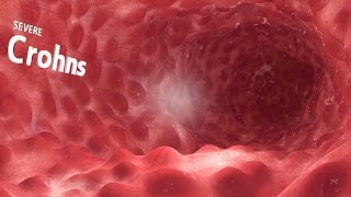 360° VR animation  inside the GI tract [upl. by Mercuri547]