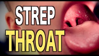 Strep Throat LIVE DIAGNOSIS [upl. by Kast264]