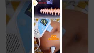 Fetal Heart sound  Nonstress Test Pregnancy nst fetal heart sound shortsvideo [upl. by Venetia]