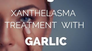 Xanthelasma treatment with garlic does it work [upl. by Dorie]