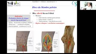 bloc moteur partie 3 MI [upl. by Mchail181]