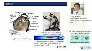 JeongHo Seok  LowIntensity FUS Stimulation in Patients with Major Depressive Disorder 2020 [upl. by Orat]