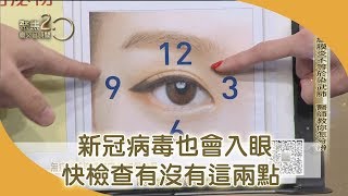 新冠病毒也侵眼！怎分辨眼科醫教看這兩點【聚焦20】第314集 [upl. by Bertine323]