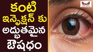 కంటి ఇన్ఫెక్షన్ కు అద్భుతమైన ఔషధం  Treatment For Eye Infection  Eagle Health [upl. by Lisabeth497]