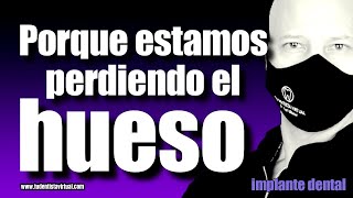 SOLUCIÓN a los PROBLEMAS que TRAEN los IMPLANTES DENTALES HOY en DÍA perdidadehueso implantes [upl. by Pollux]