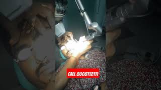 Laser removal of the Nevus of ota 4th sitting at cosmos vizag Dr gopal krishna MD doctor [upl. by Ilyk]