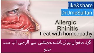 Allergic Rhinitis homeo medicine dust allergic pollen allergy tips and tricks vlogs pakistani [upl. by Rellim709]