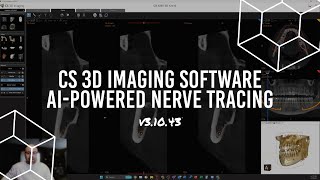 Carestream Dental CBCT  AIpowered Nerve Tracing in v31043 [upl. by Synn]