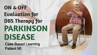 ON OFF Evaluation for DBS levodopa Challenge test for Parkinson Disease Clinical based learning [upl. by Liman]