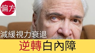 白內障自然療法｜有效減緩視力退化 [upl. by Sabrina]