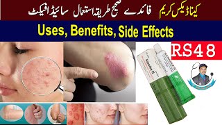 Kanadex N Cream Used For  Kanadex N Cream Review  Kenadex N Cream Ke Fayde  Dr Shahzad Official [upl. by Niwri151]