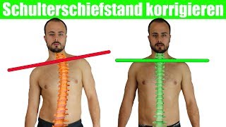 Schulterschiefstand beheben  Krumme Wirbelsäule  Brustkorb aufrichten [upl. by Derrek805]