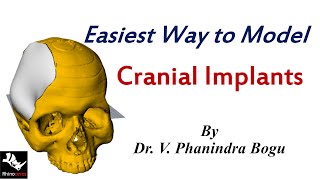 Cranial implant modelling Easiest way 3D Printing [upl. by Bowlds]