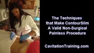 ContourSlim Cavitation RF Training Trully Makes The Difference [upl. by Lerrud]