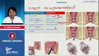 CX GENERAL  PATOLOGÍA ANORRECTAL  2024 QX MEDIC [upl. by Burdelle]