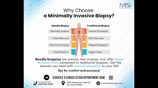 Why Choose a Needle Biopsy [upl. by Nabalas]