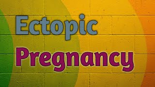 Ectopic Pregnancy  Part  1  OBG Lecture [upl. by Aruam]