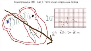 Descomplicando o ECG Aula 9  Ritmo sinusal e introdução a arritmias [upl. by Oisacin]