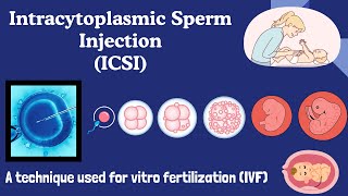 Intracytoplasmic Sperm Injection ICSI  In vitro Fertilization IVF  Explained [upl. by Ennaed550]