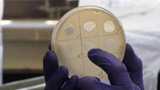 Titering Phage  spot and whole plate methods [upl. by Wilhelm62]