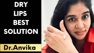 Dry skin care tips this winter by Dr Anvika [upl. by Liss886]