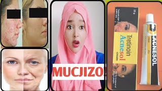 Acnesol cream review  maxaa loo isticmala Yase isticmali Kara waa MUHIIM fadlan daawo videoga [upl. by Paehpos]