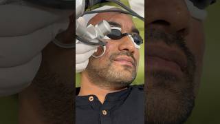 Best Laser treatment for your face [upl. by Tamara510]