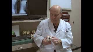 Dr Randall Dryer Discusses coflexF®  Paradigm Spine [upl. by Vernon]