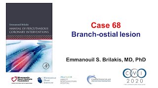 Case 68  PCI Manual  Branch ostial lesion [upl. by Netniuq242]