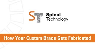 How Your Custom Brace Gets Fabricated [upl. by Phonsa]