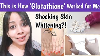 Glutathione Works for Skin Whitening For Tan removal Pigmentations Glutathione before and after [upl. by Arinaj]