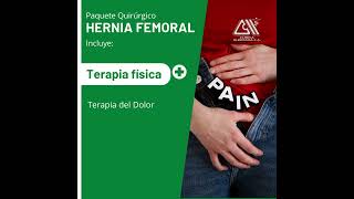 hernia femoral [upl. by Littell]